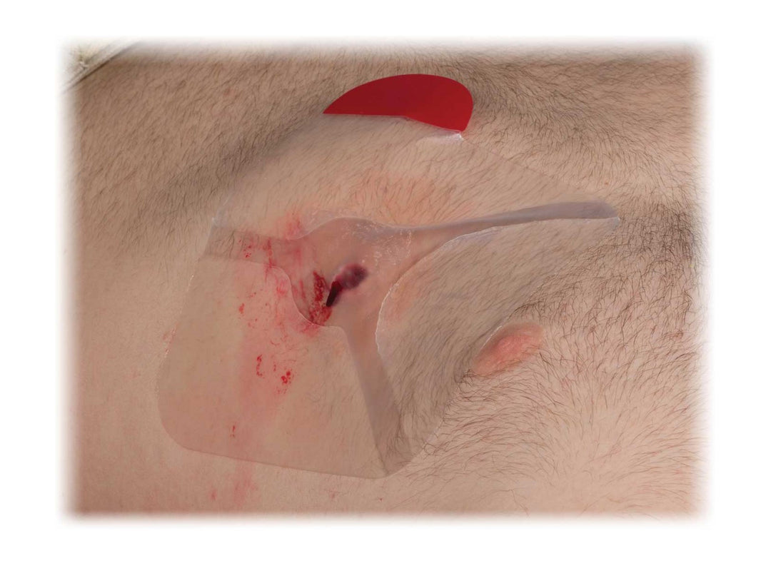 NAR HyFin Vent Chest Seal Twin Pack
